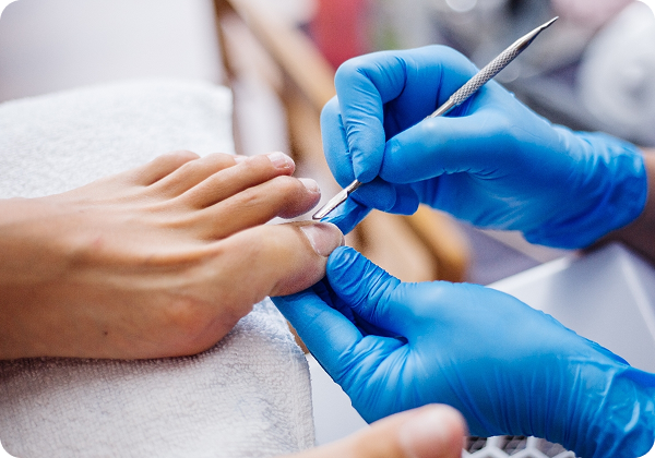 Fungal Nail Treatment